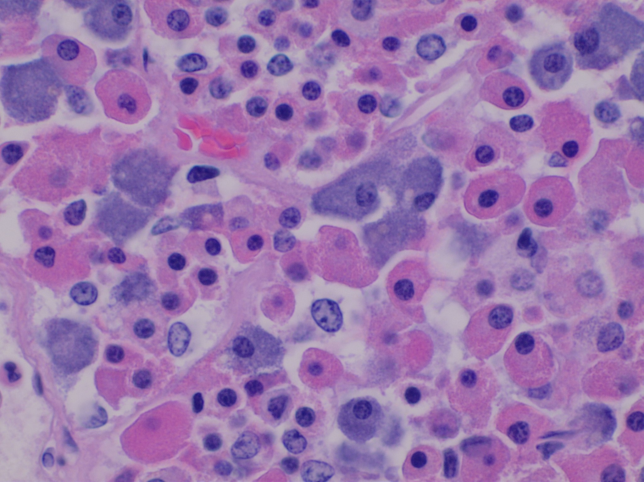 Anterior pituitary — acidophils, basophils, chromophobes — Pars distalis, H&E stain