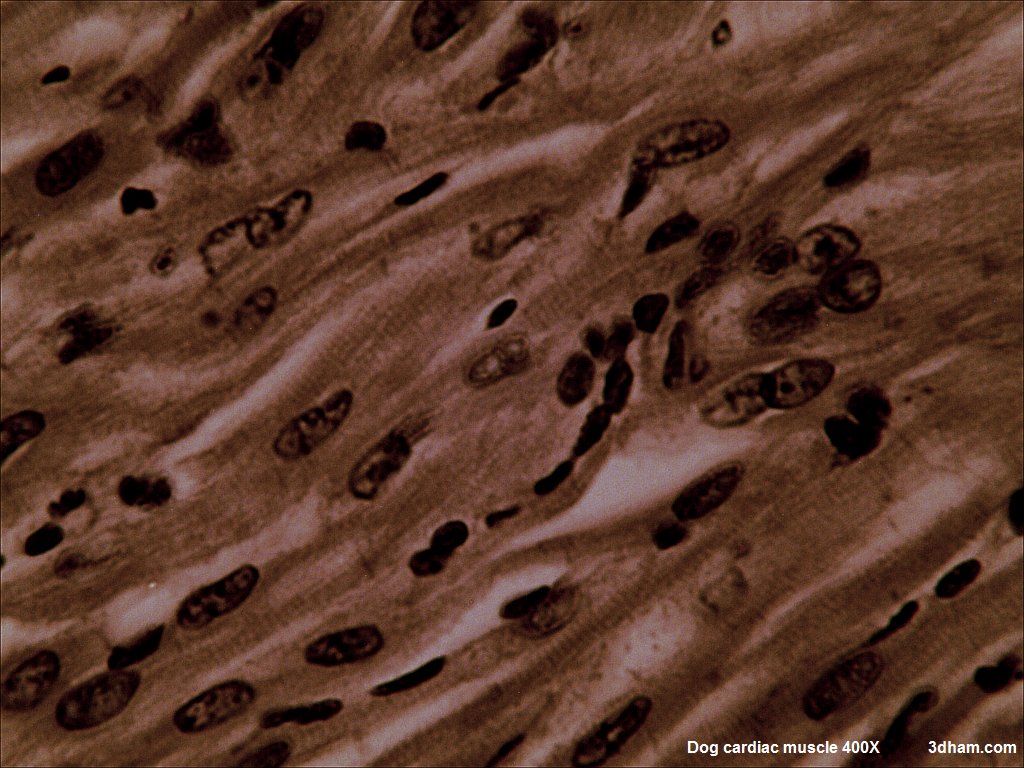 Cardiac muscle â€” intercalated discs — Cardiac muscle, H&E stain