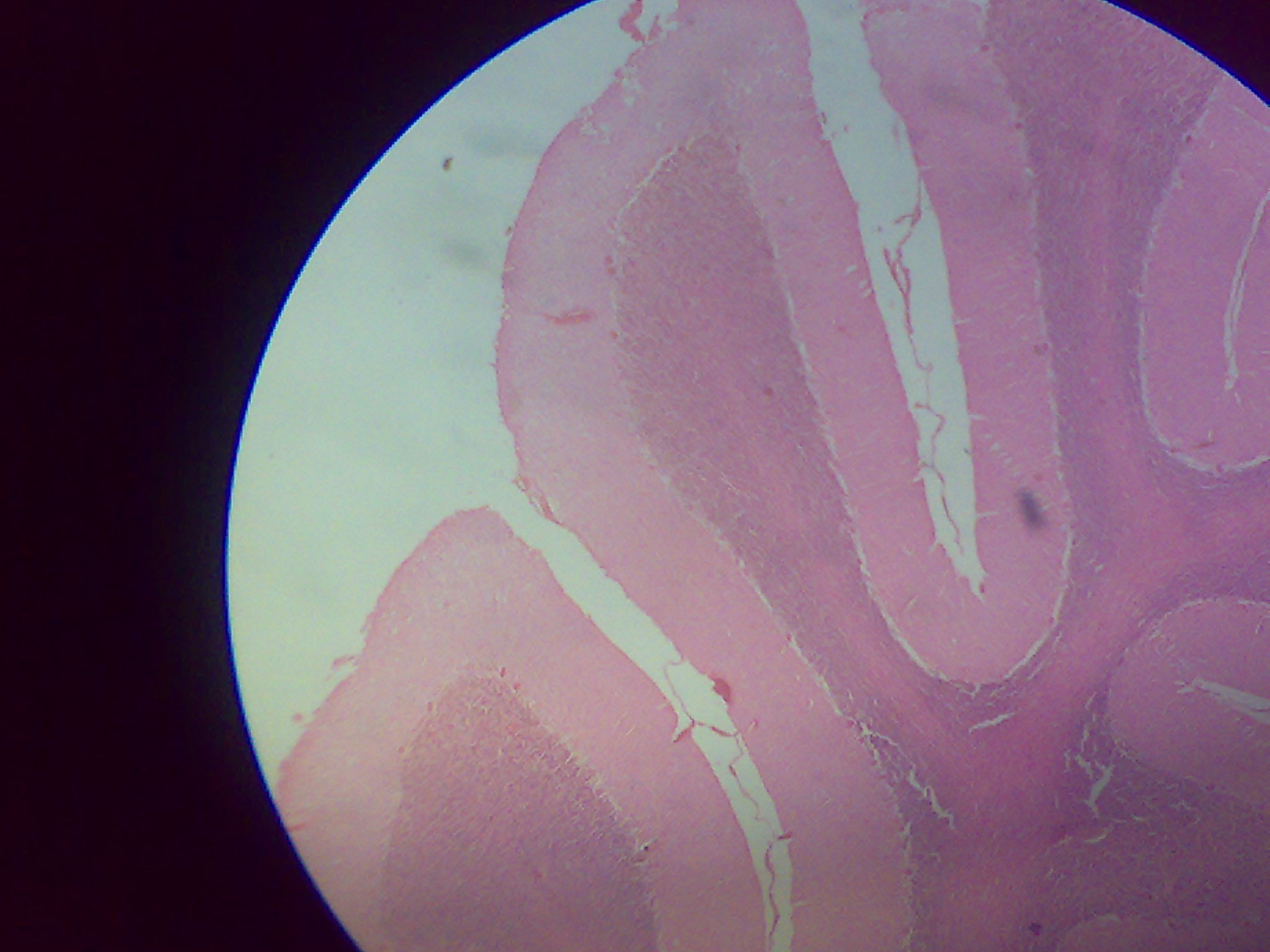 Cerebellum — Purkinje cell layer — Cerebellar cortex (molecular, Purkinje, granular layers), H&E stain