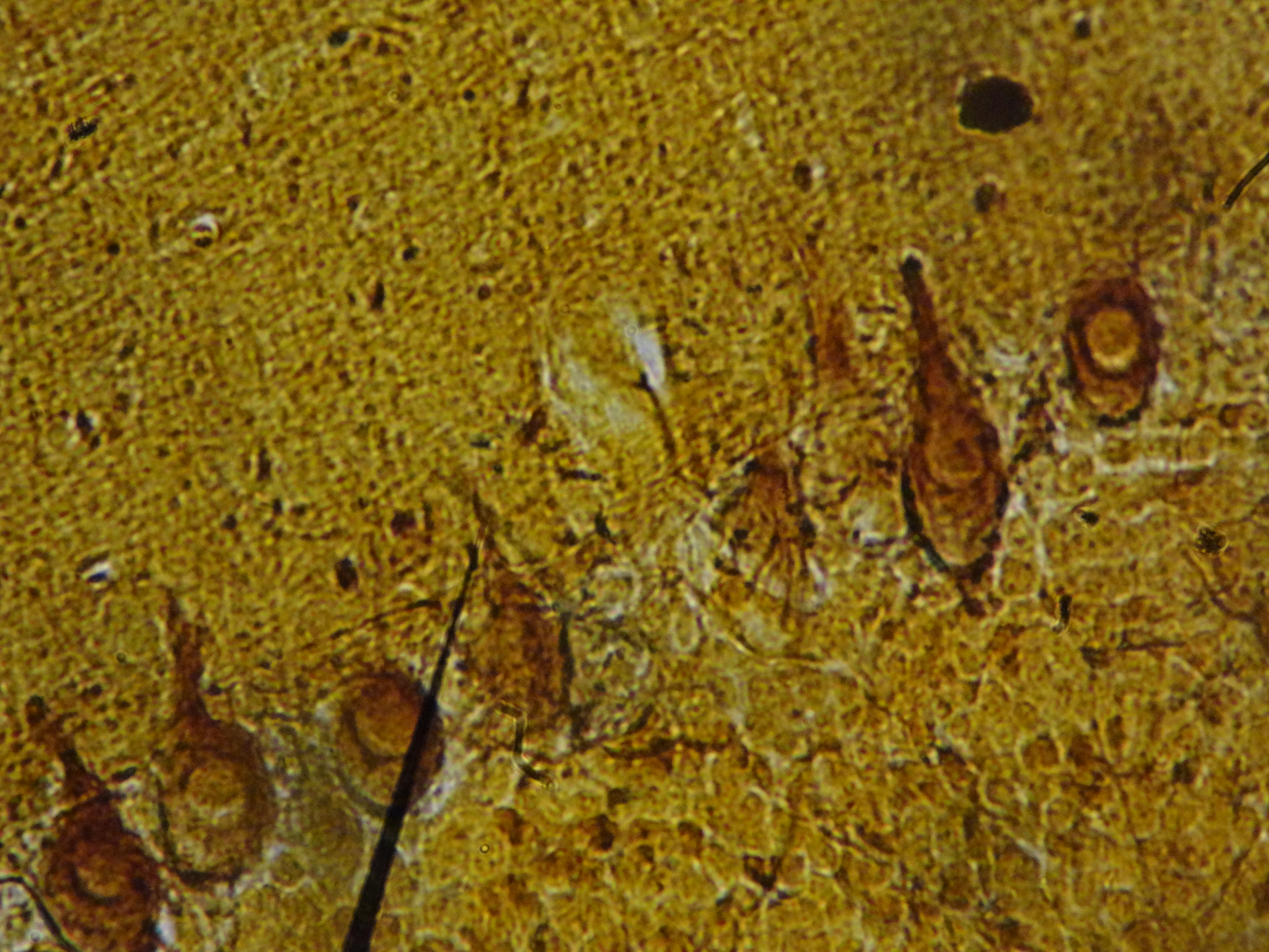 Cerebral cortex — pyramidal neurons — CNS — six-layered neocortex, H&E stain