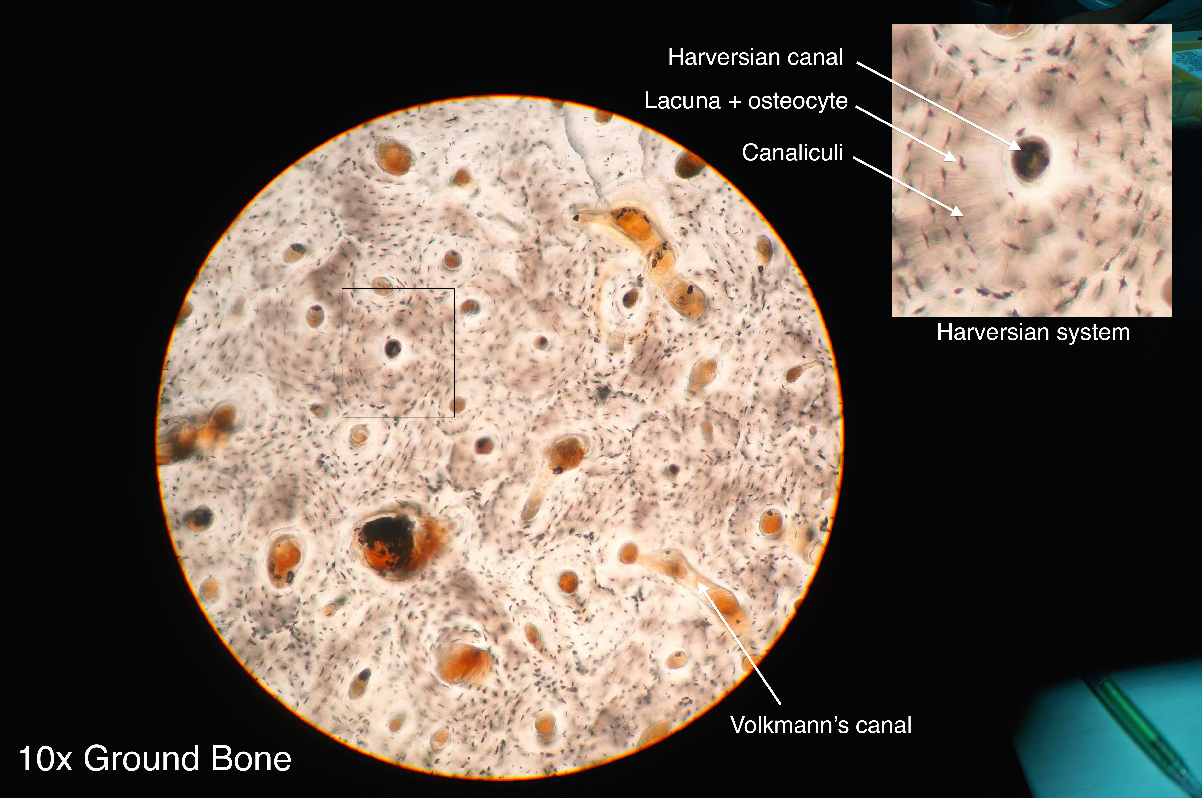 Compact bone â€” osteon (Haversian system) — Lamellar bone, H&E stain