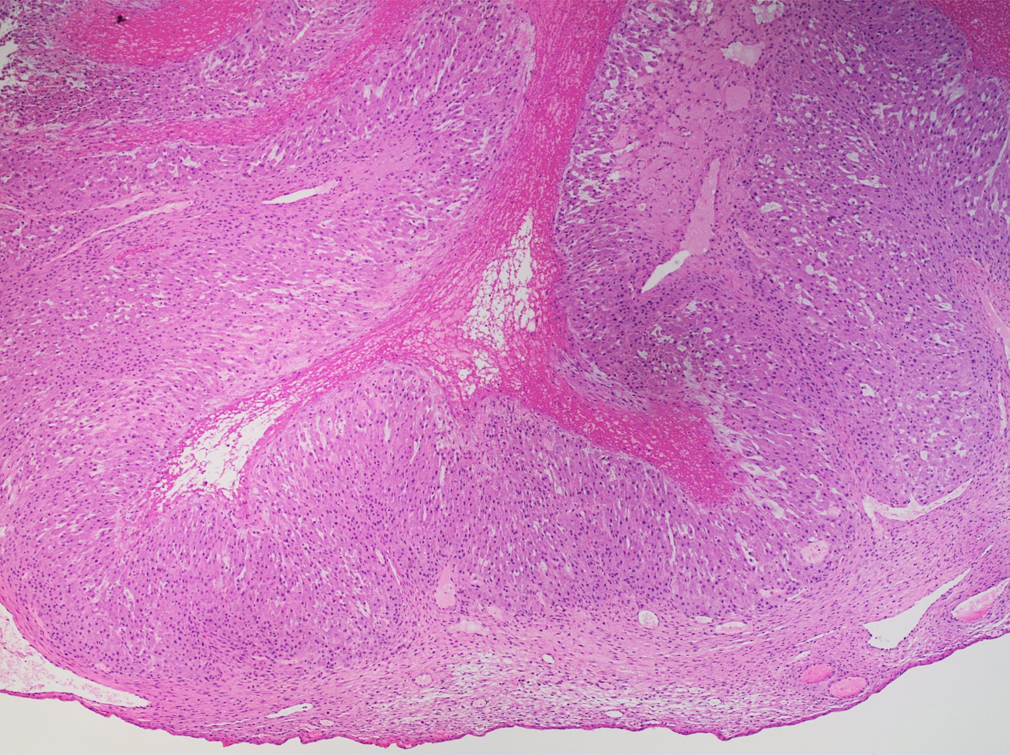 Corpus luteum — luteinized granulosa + theca cells — Post-ovulatory follicle, H&E stain