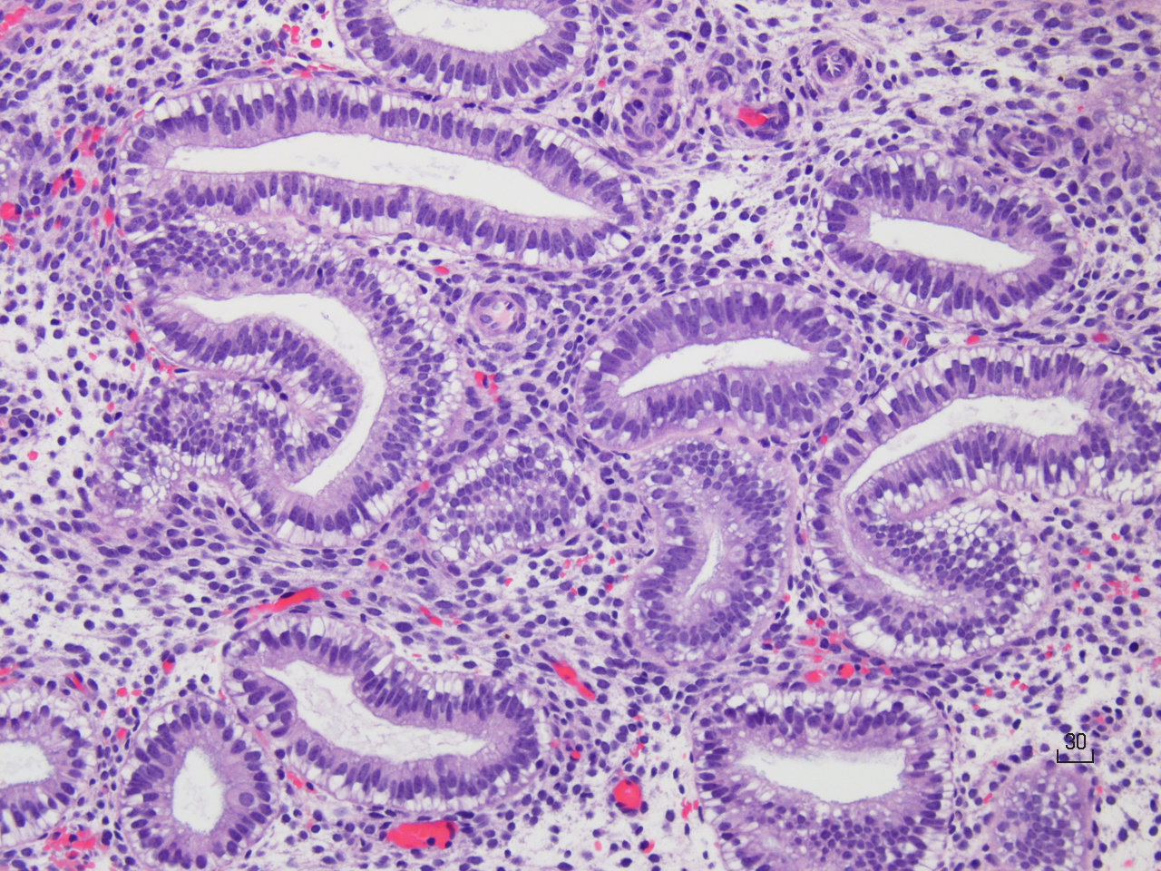 Endometrium — secretory phase — Endometrial glands + stroma, H&E stain