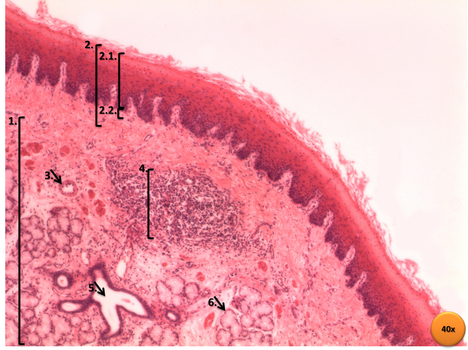 Esophagus — non-keratinized stratified squamous epithelium — Stratified squamous epithelium, non-keratinized, H&E stain