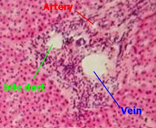 Liver â€” classic hepatic lobule — Hepatic parenchyma, H&E stain