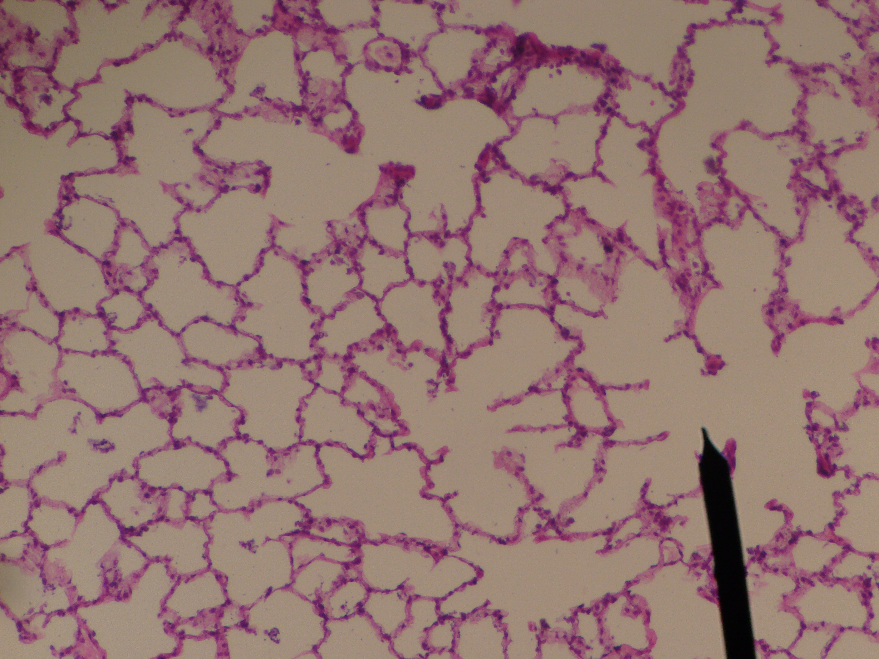 Lung â€” alveolar parenchyma — Alveolar, H&E stain
