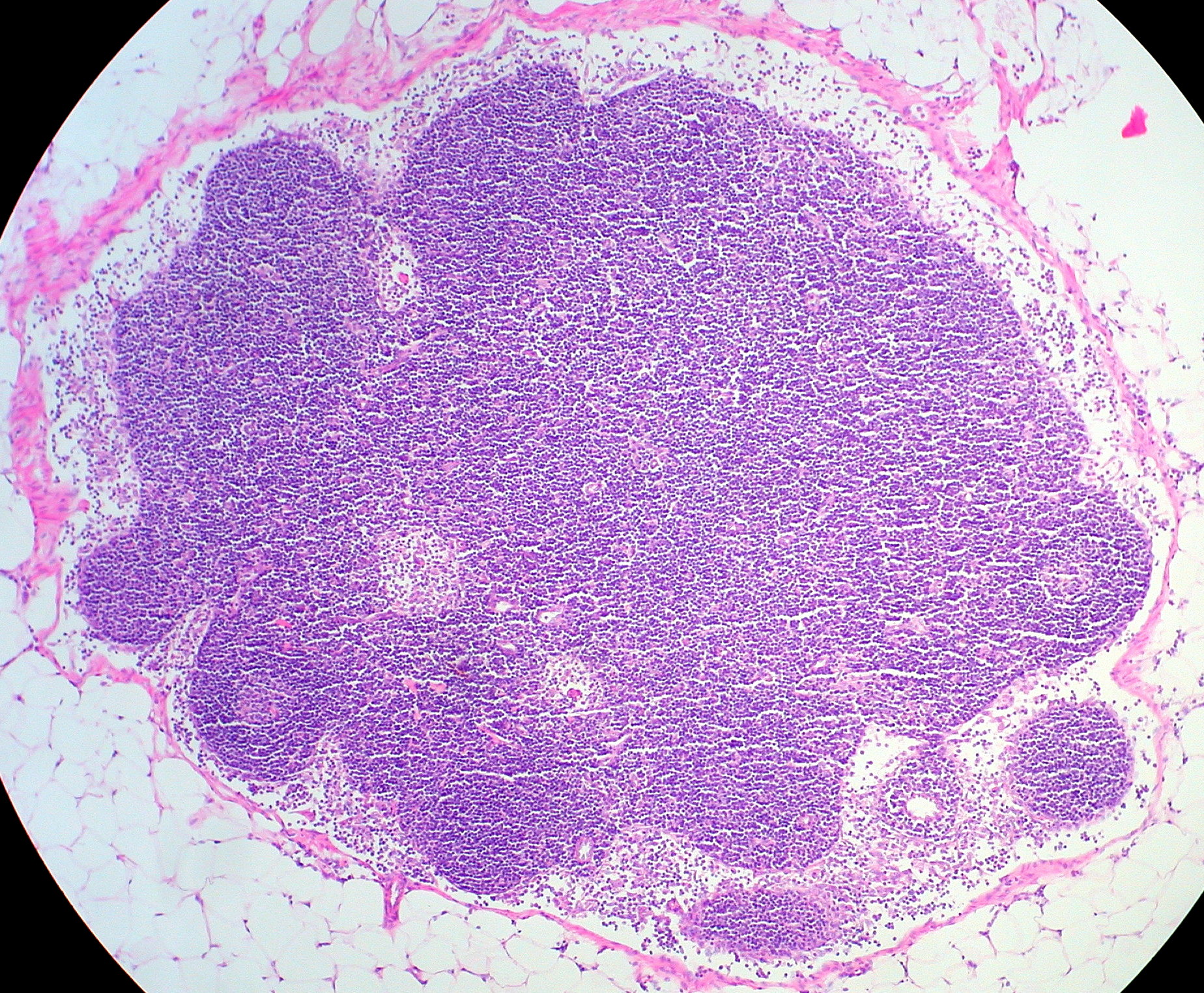 Lymph node â€” cortex / paracortex / medulla — Secondary lymphoid, H&E stain