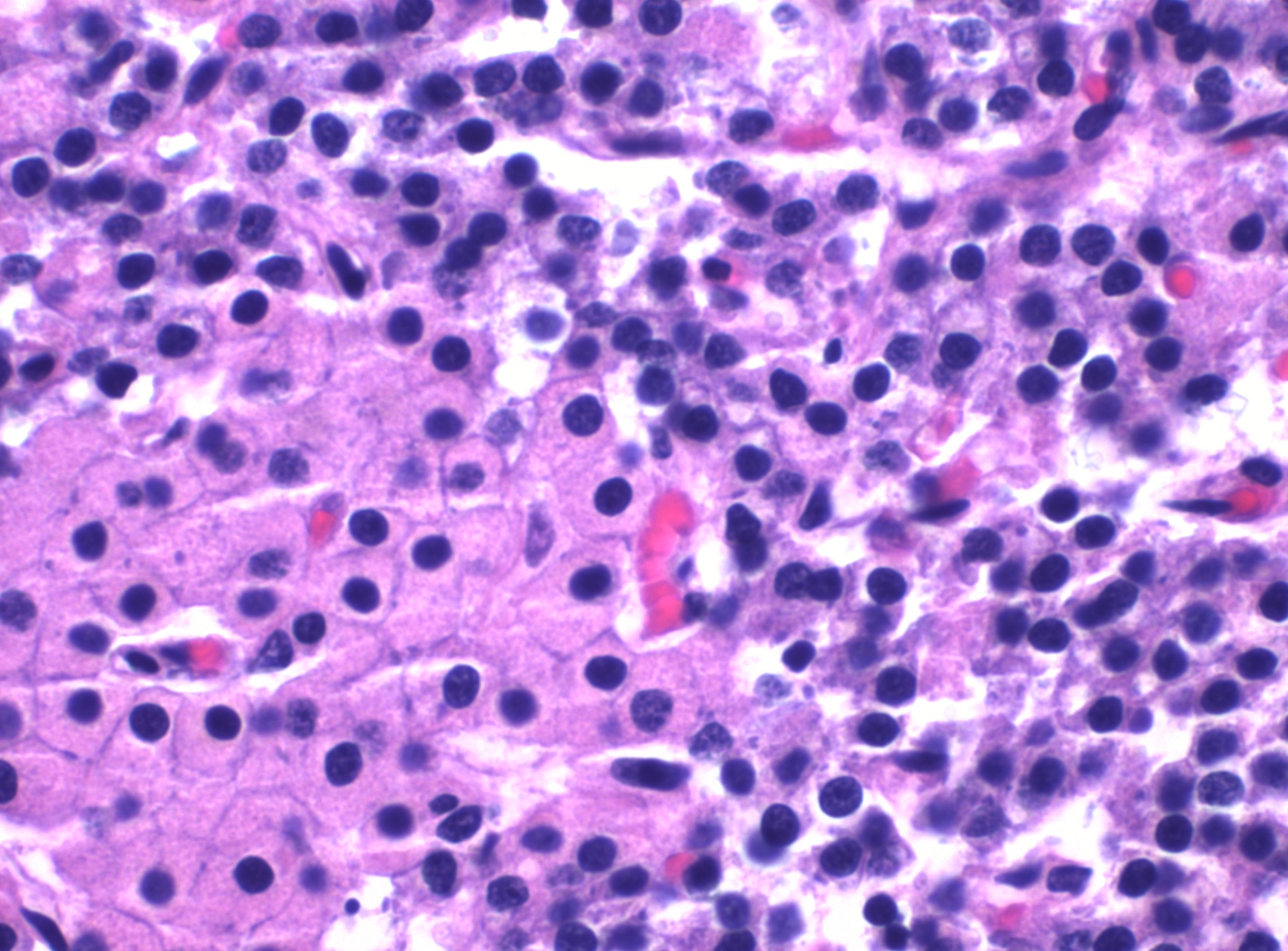 Parathyroid — chief + oxyphil cells — Endocrine parenchyma, H&E stain