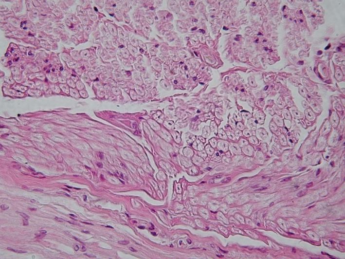 Peripheral nerve â€” cross section — Mixed nerve fascicles, H&E stain