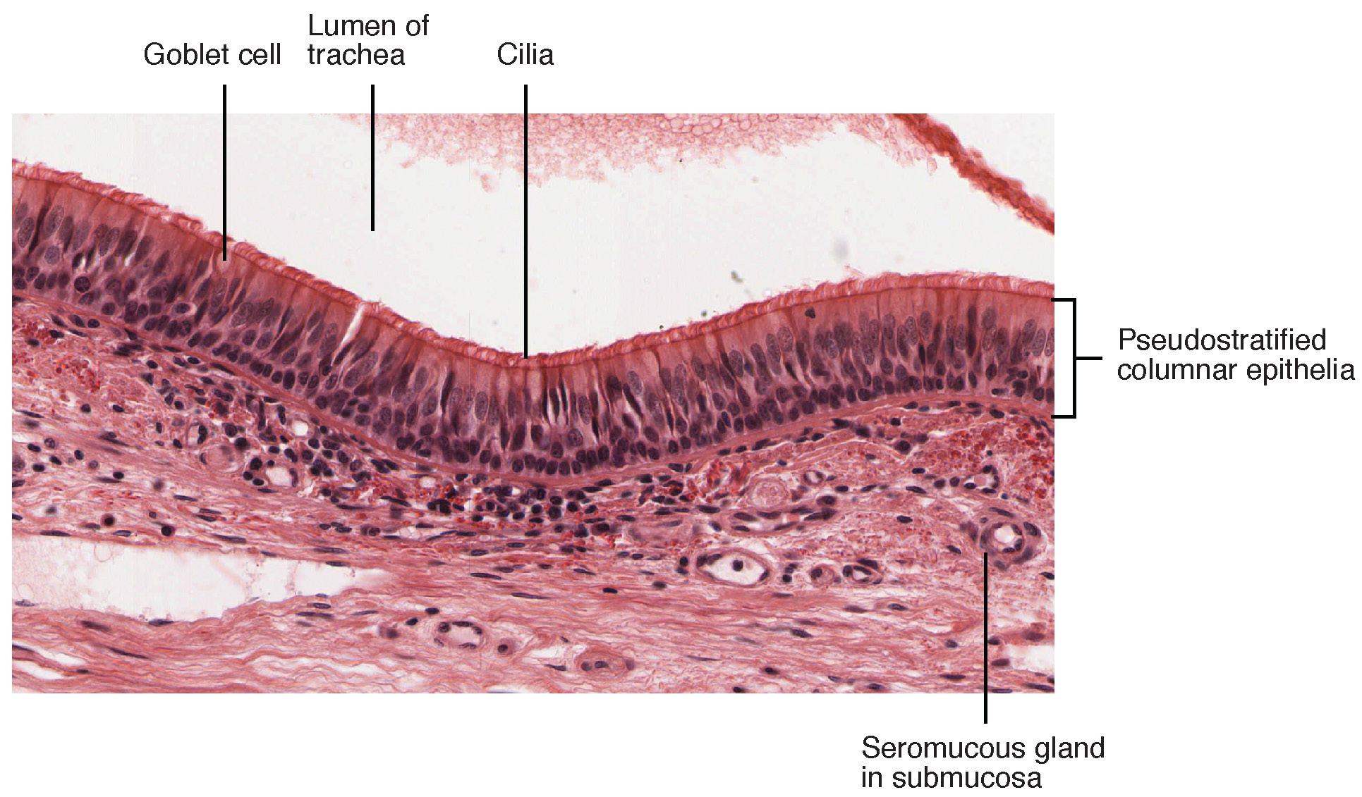 Pseudostratified ciliated columnar epithelium â€” trachea — Pseudostratified ciliated columnar, H&E stain