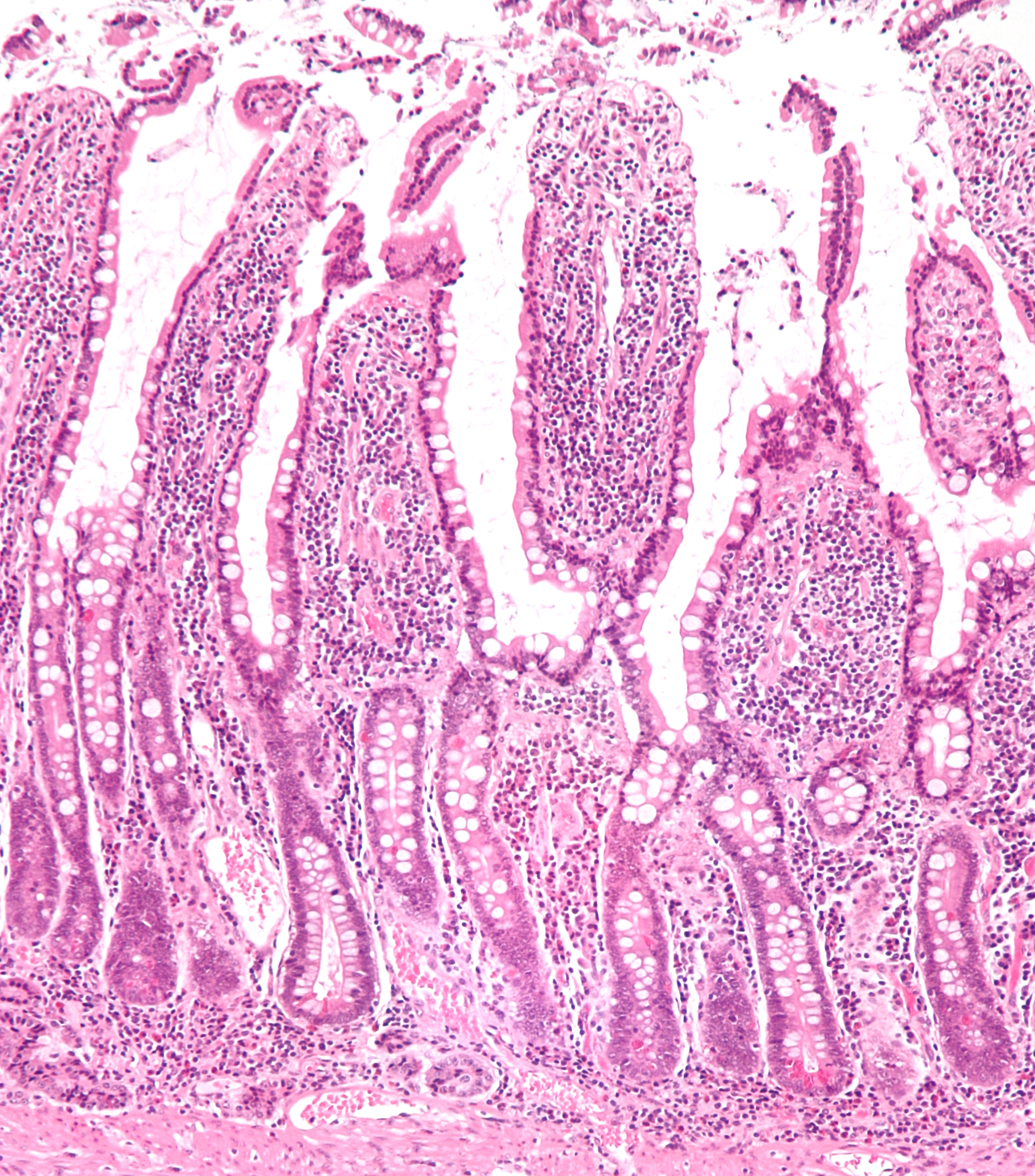 Simple columnar epithelium â€” small intestine villus — Simple columnar with microvilli, H&E stain