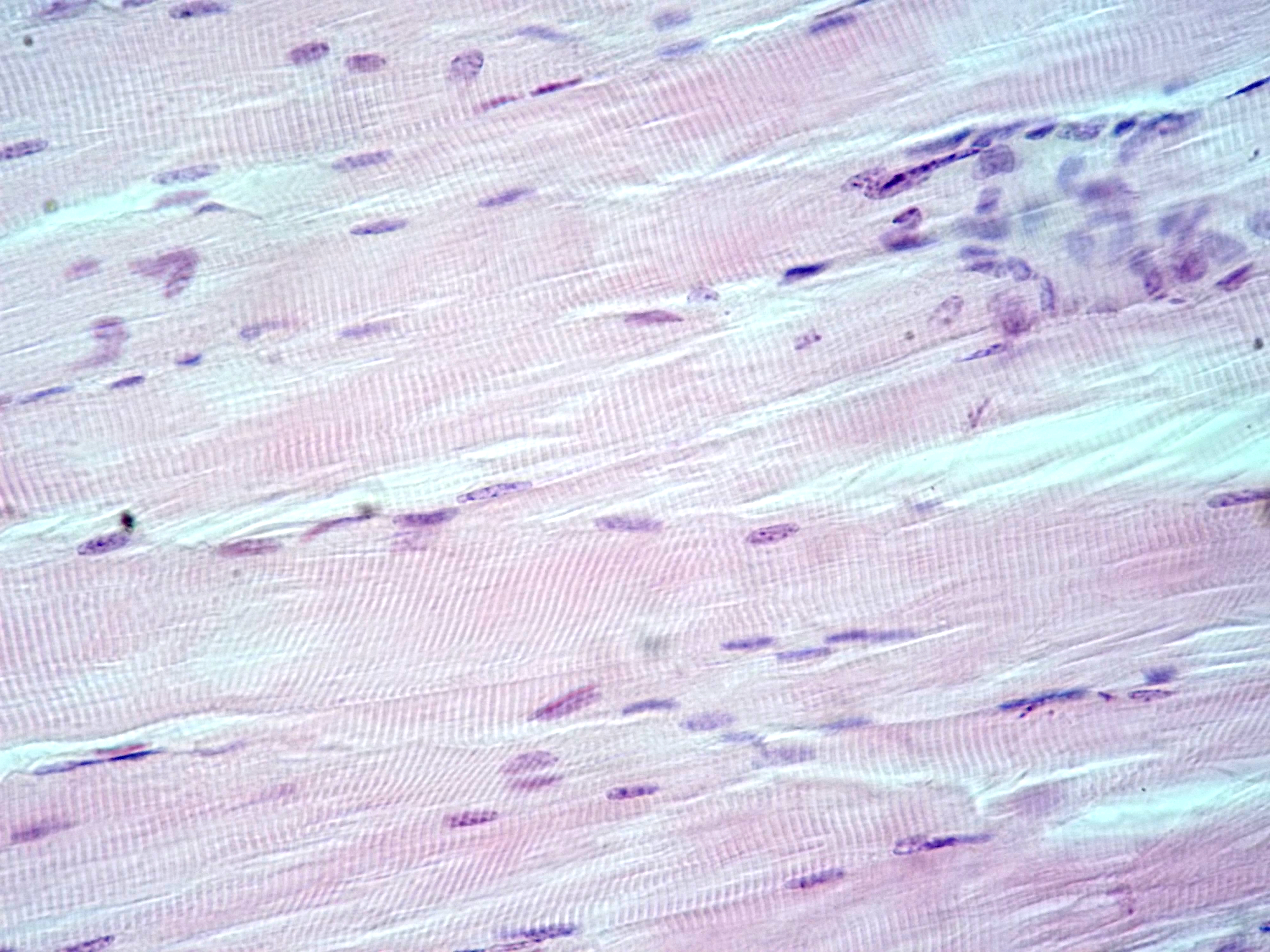 Skeletal muscle â€” longitudinal section — Skeletal muscle, H&E stain