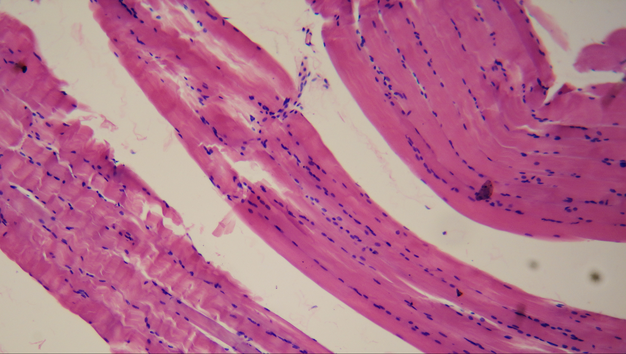 Smooth muscle â€” bladder wall (detrusor) — Smooth muscle, H&E stain
