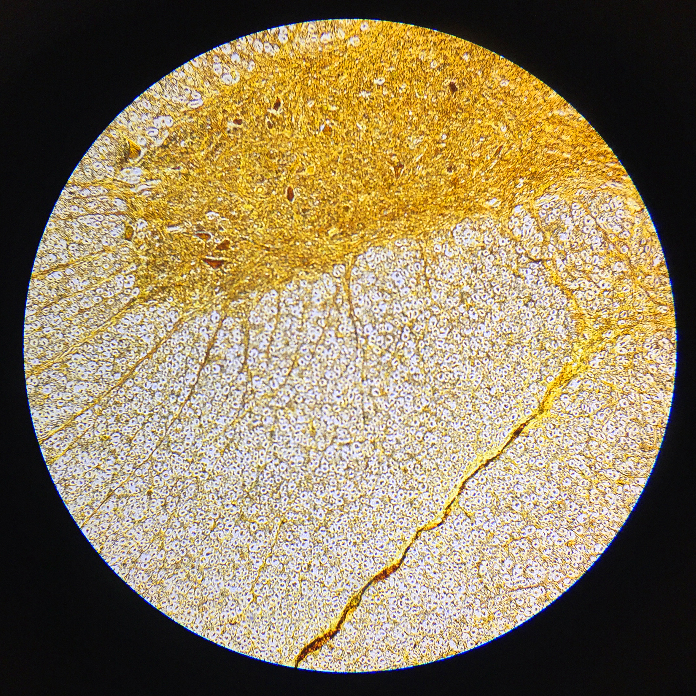 Spinal cord — cross section with gray matter horns — CNS — gray + white matter, H&E stain