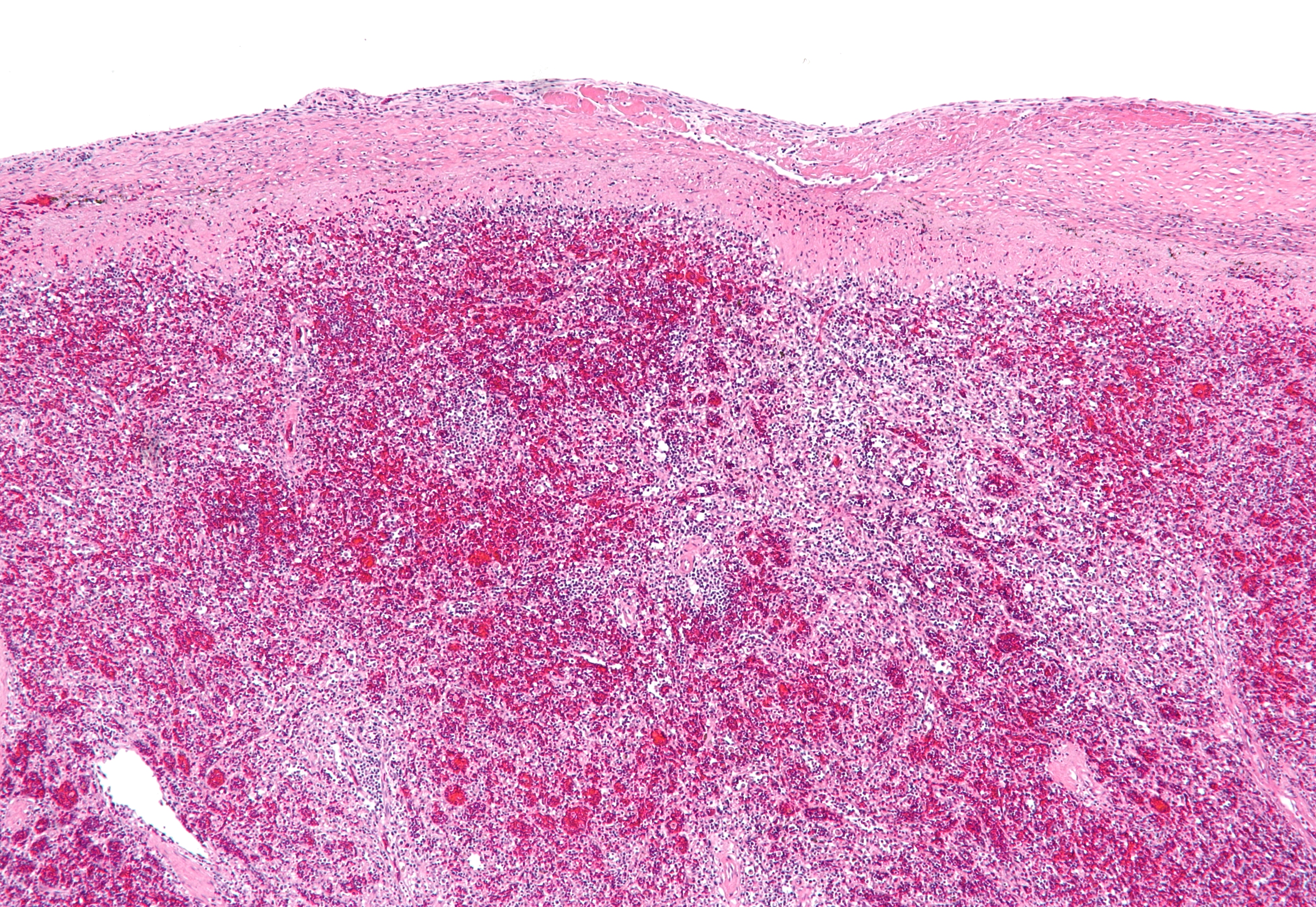 Spleen â€” white pulp + red pulp — Lymphoreticular, H&E stain