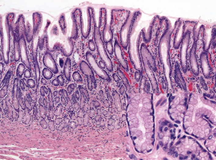 Stomach â€” fundic mucosa with parietal + chief cells — Gastric mucosa, H&E stain