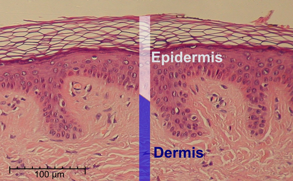 Stratified squamous epithelium (keratinized) â€” thin skin — Stratified squamous epithelium, keratinized, H&E stain