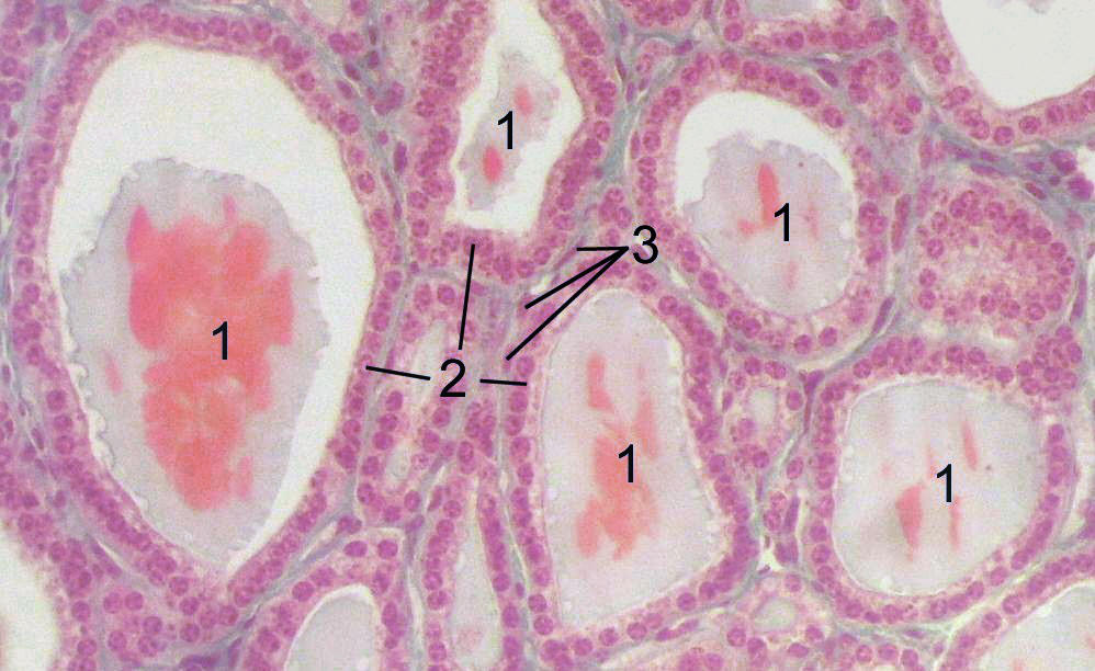 Thyroid â€” follicles + colloid — Follicular epithelium, H&E stain