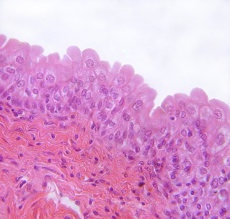 Transitional epithelium (urothelium) â€” urinary bladder — Transitional epithelium, H&E stain