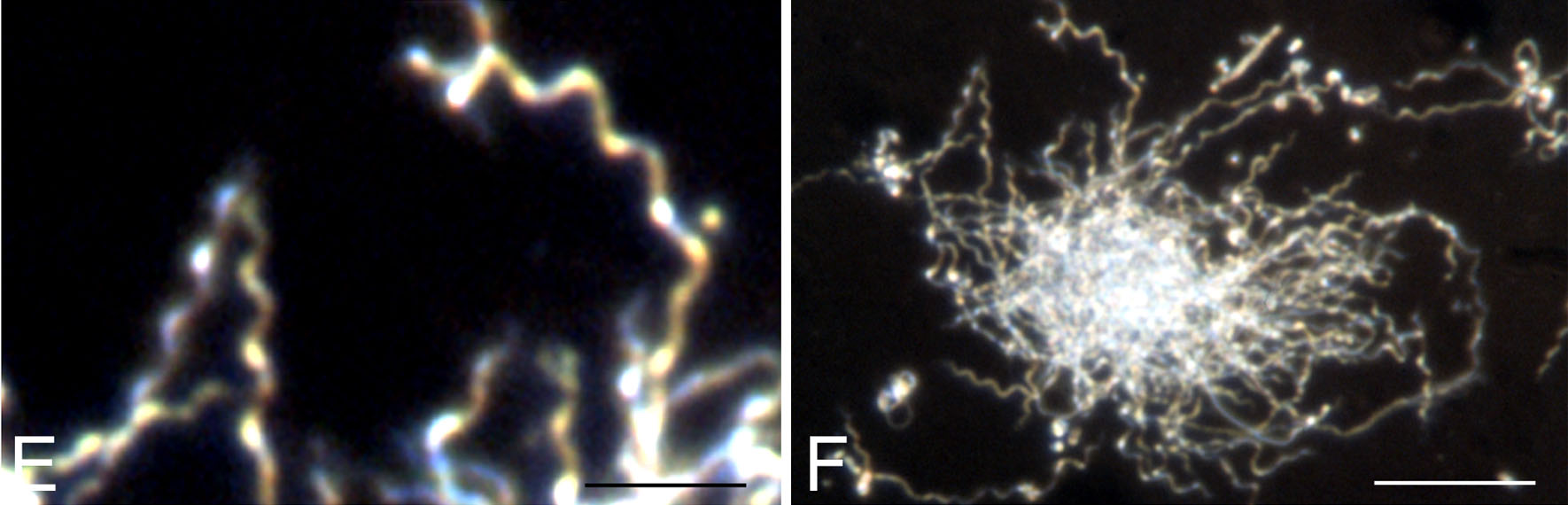 Borrelia burgdorferi — Spirochete