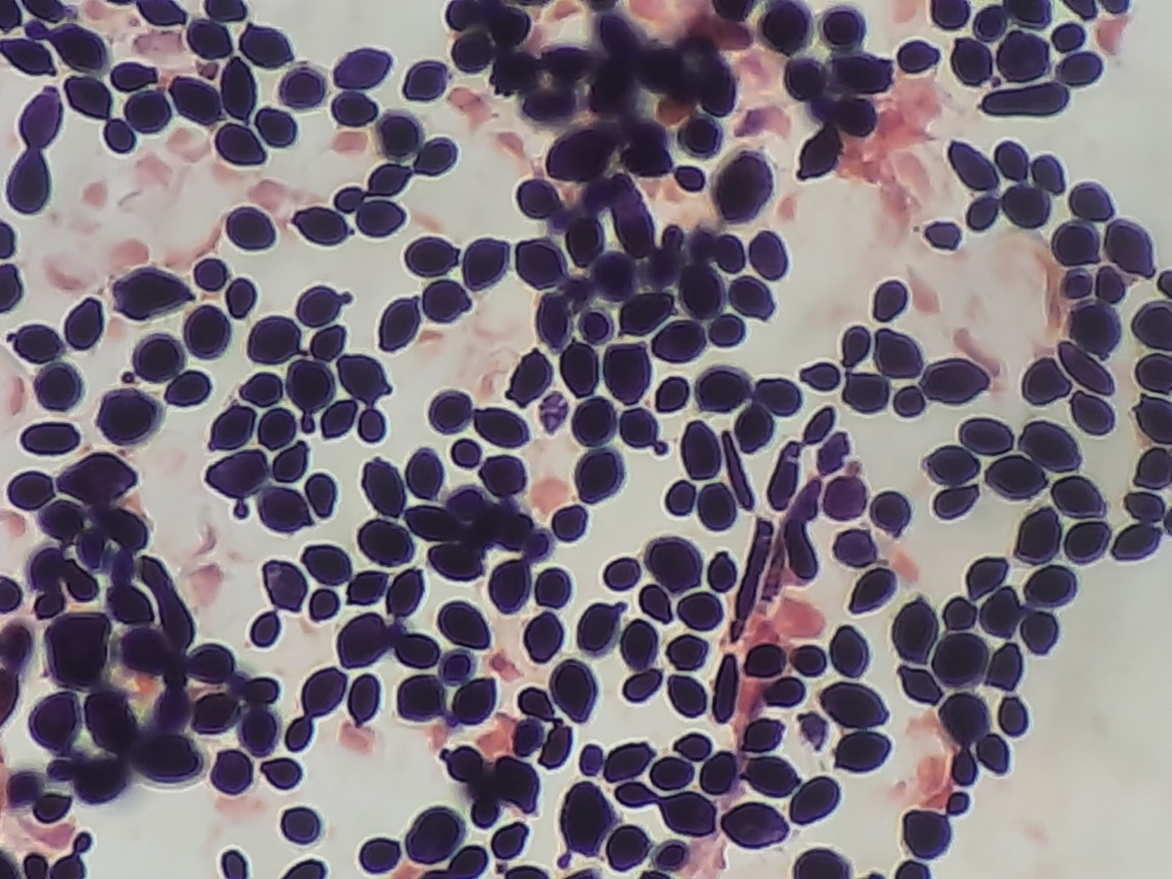 Candida albicans — Yeast (dimorphic)