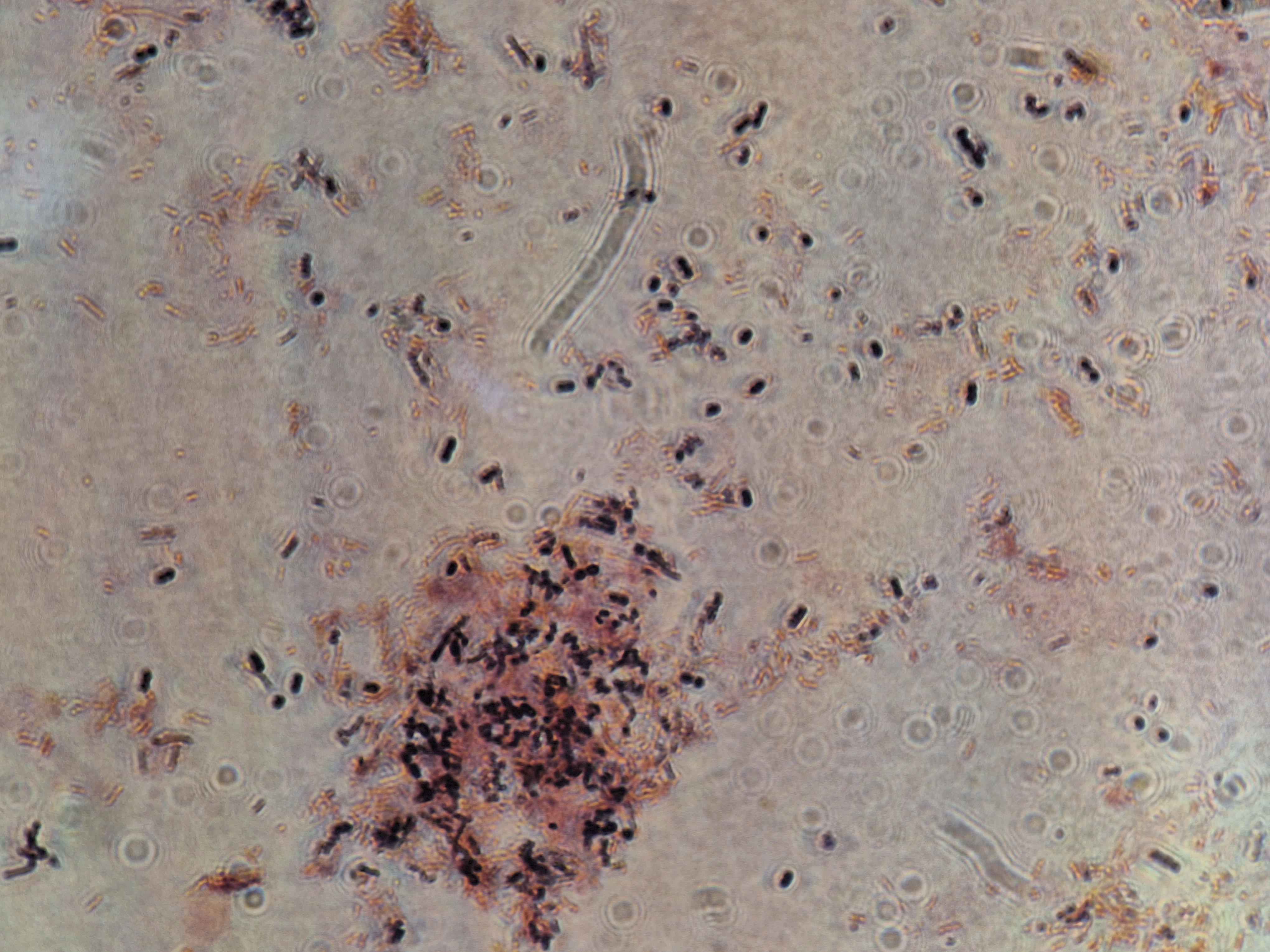 Clostridioides (Clostridium) difficile — Gram-positive spore-forming anaerobic rod