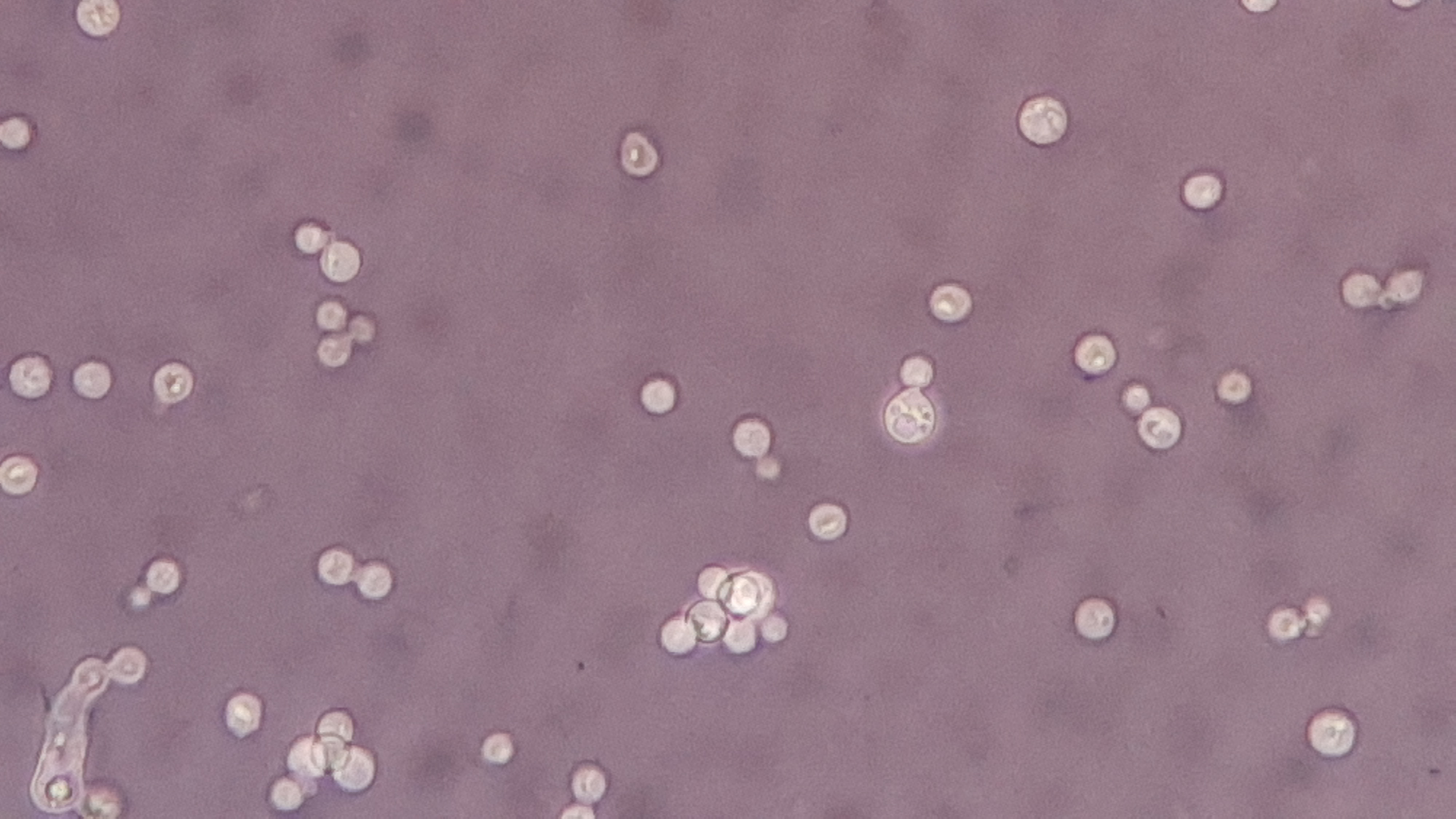 Cryptococcus neoformans — Encapsulated yeast