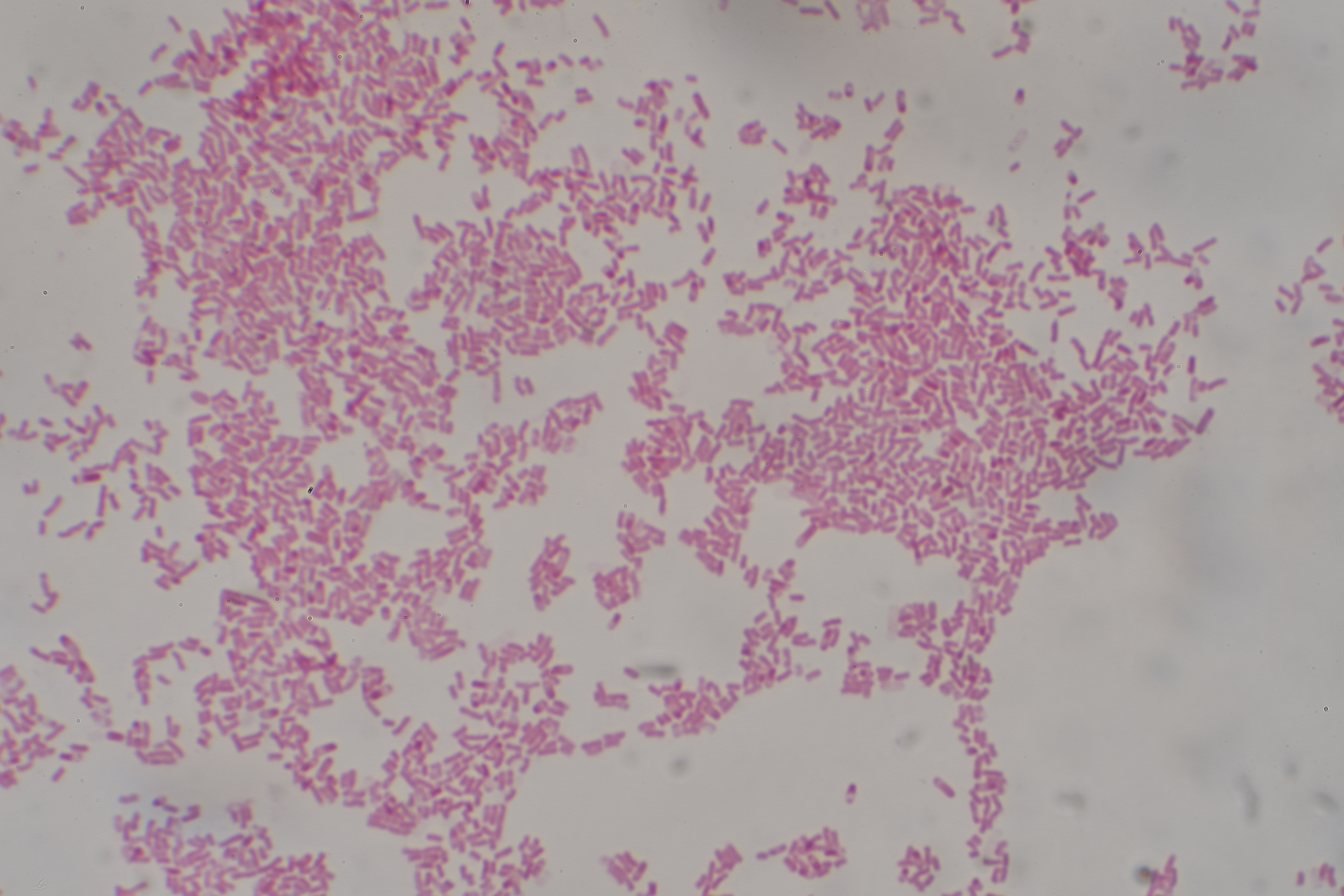 Escherichia coli — Gram-negative rods (Enterobacteriaceae)