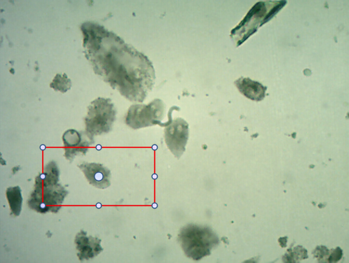 Giardia lamblia (G. duodenalis / intestinalis) — Flagellated protozoan