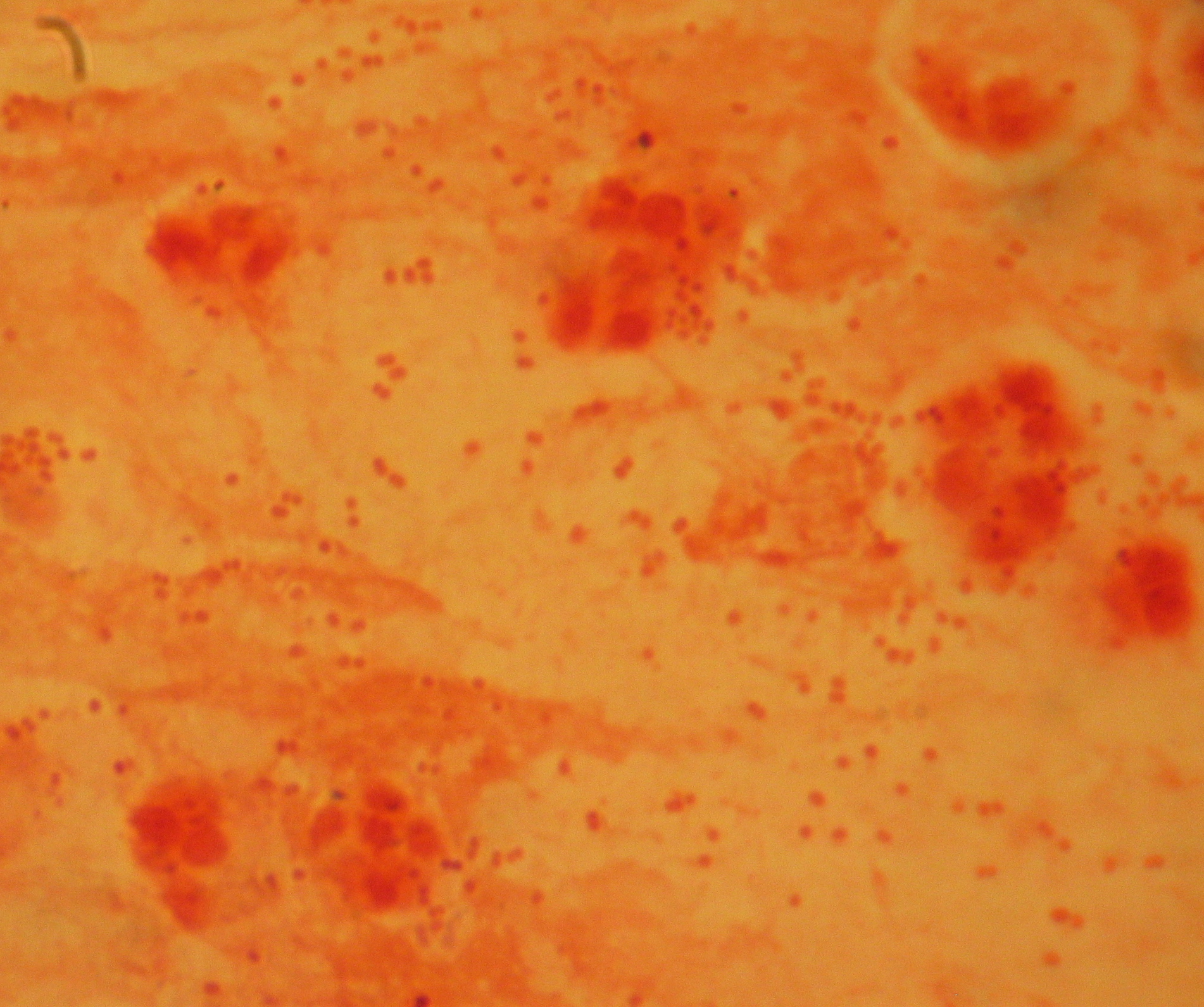 Haemophilus influenzae — Gram-negative coccobacillus