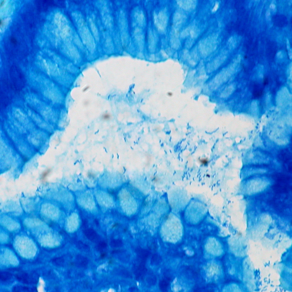 Helicobacter pylori — Gram-negative curved/spiral rod