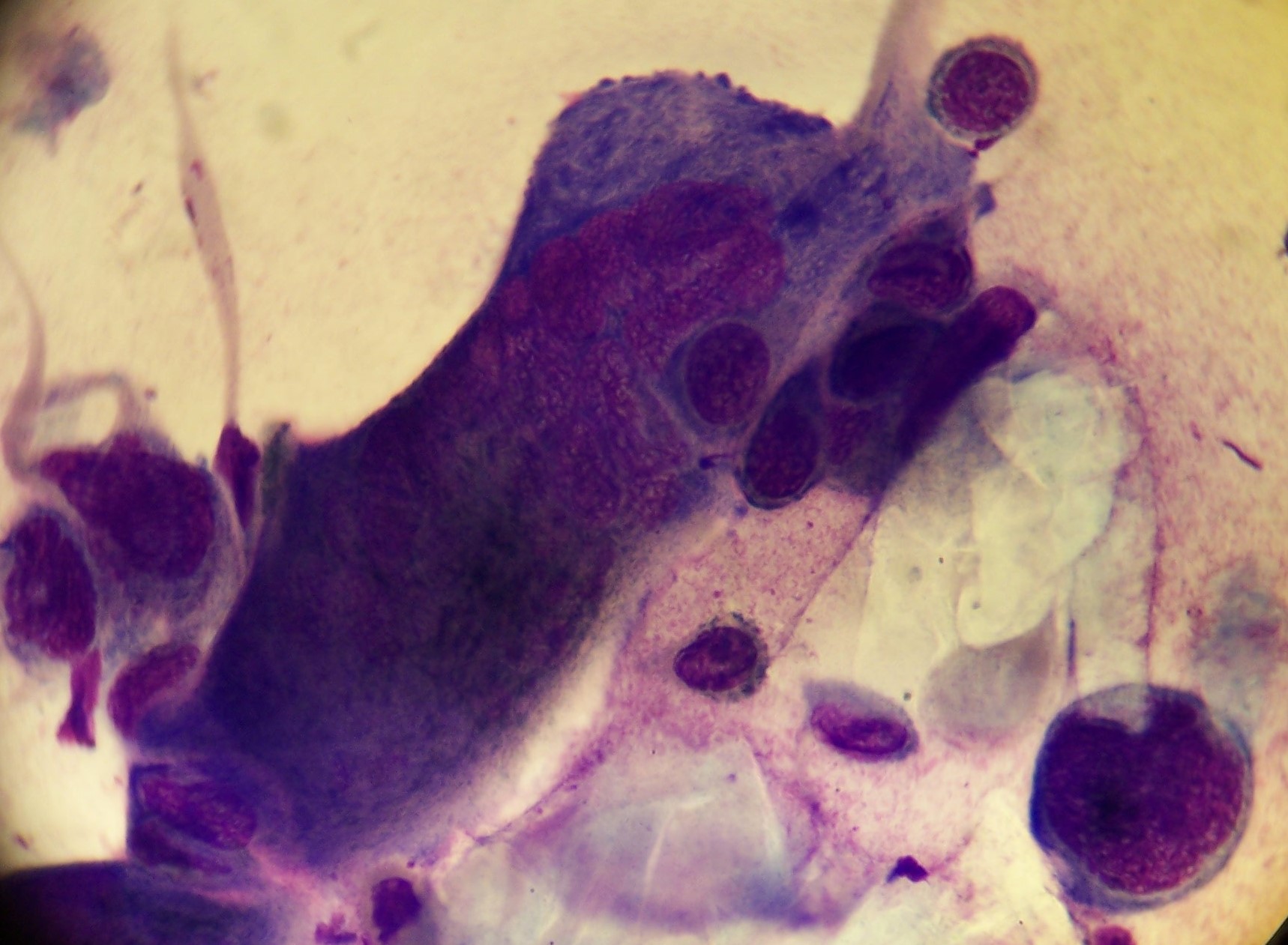 Herpes Simplex Virus (HSV-1/HSV-2) — Enveloped dsDNA herpesvirus (α-herpesvirus)