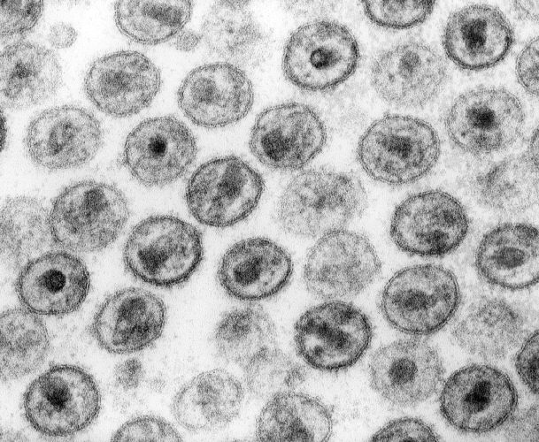 Human Immunodeficiency Virus 1 — Enveloped ssRNA retrovirus (diploid)