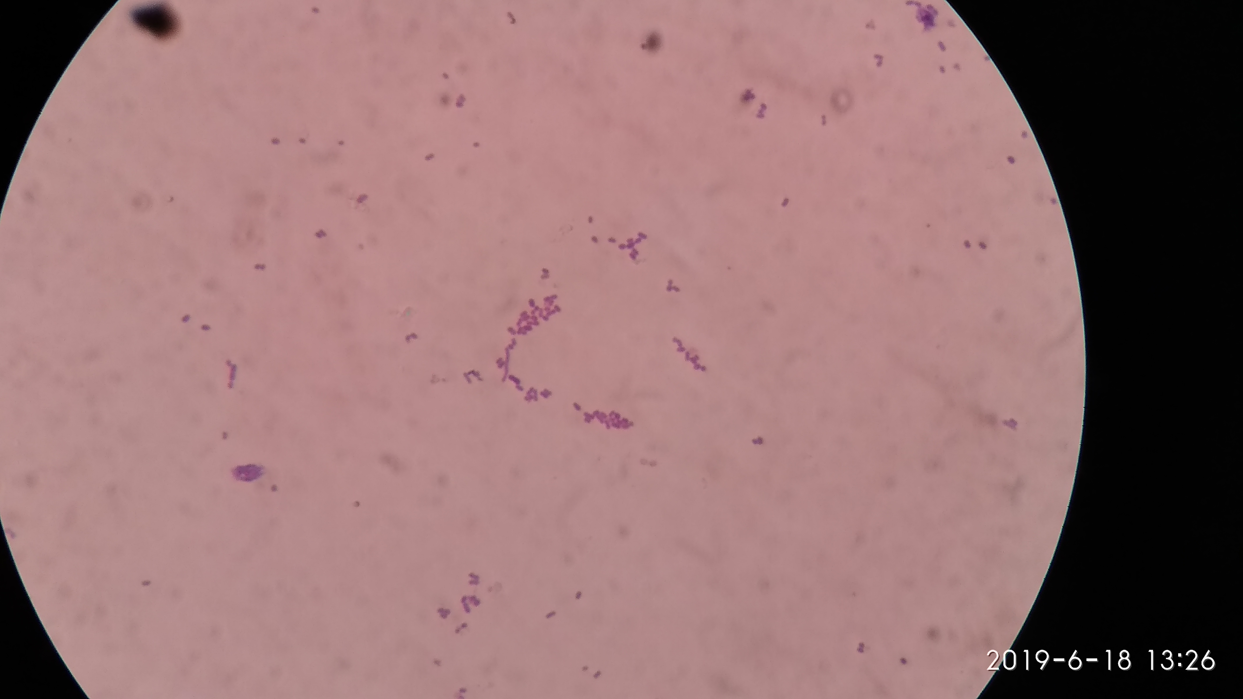 Listeria monocytogenes — Gram-positive rod (facultative intracellular)