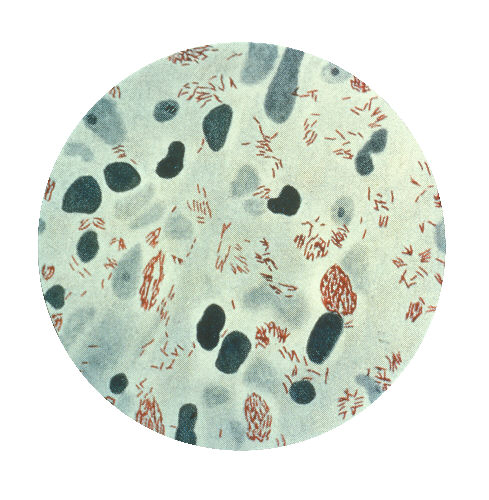Mycobacterium leprae — Acid-fast bacillus (obligate intracellular)