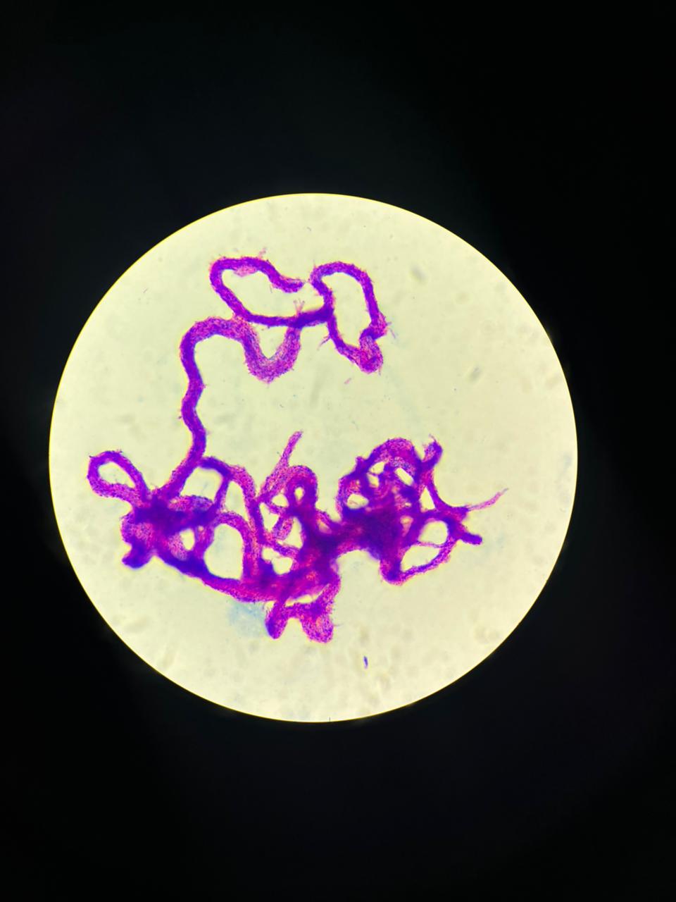 Mycobacterium tuberculosis — Acid-fast bacillus (mycolic acid cell wall)