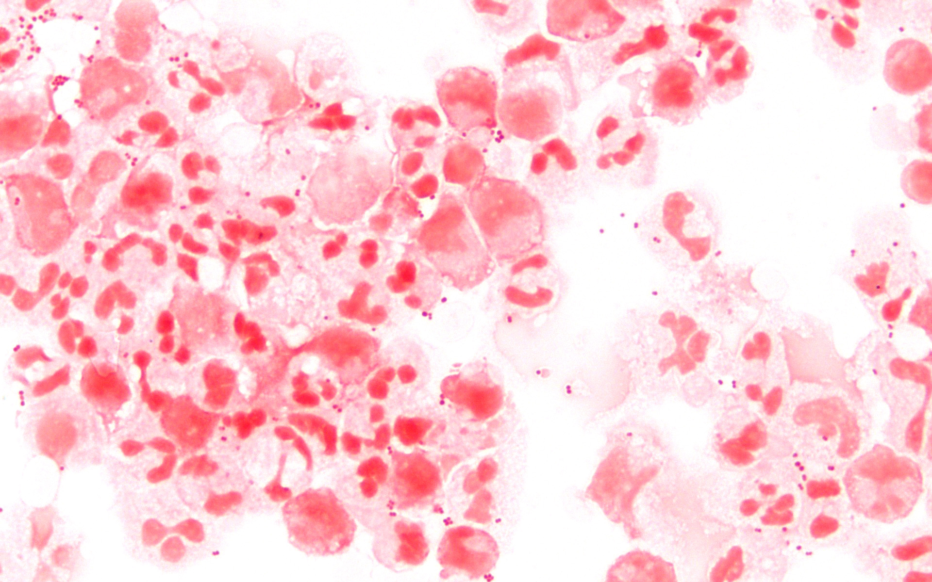 Neisseria meningitidis — Gram-negative diplococci