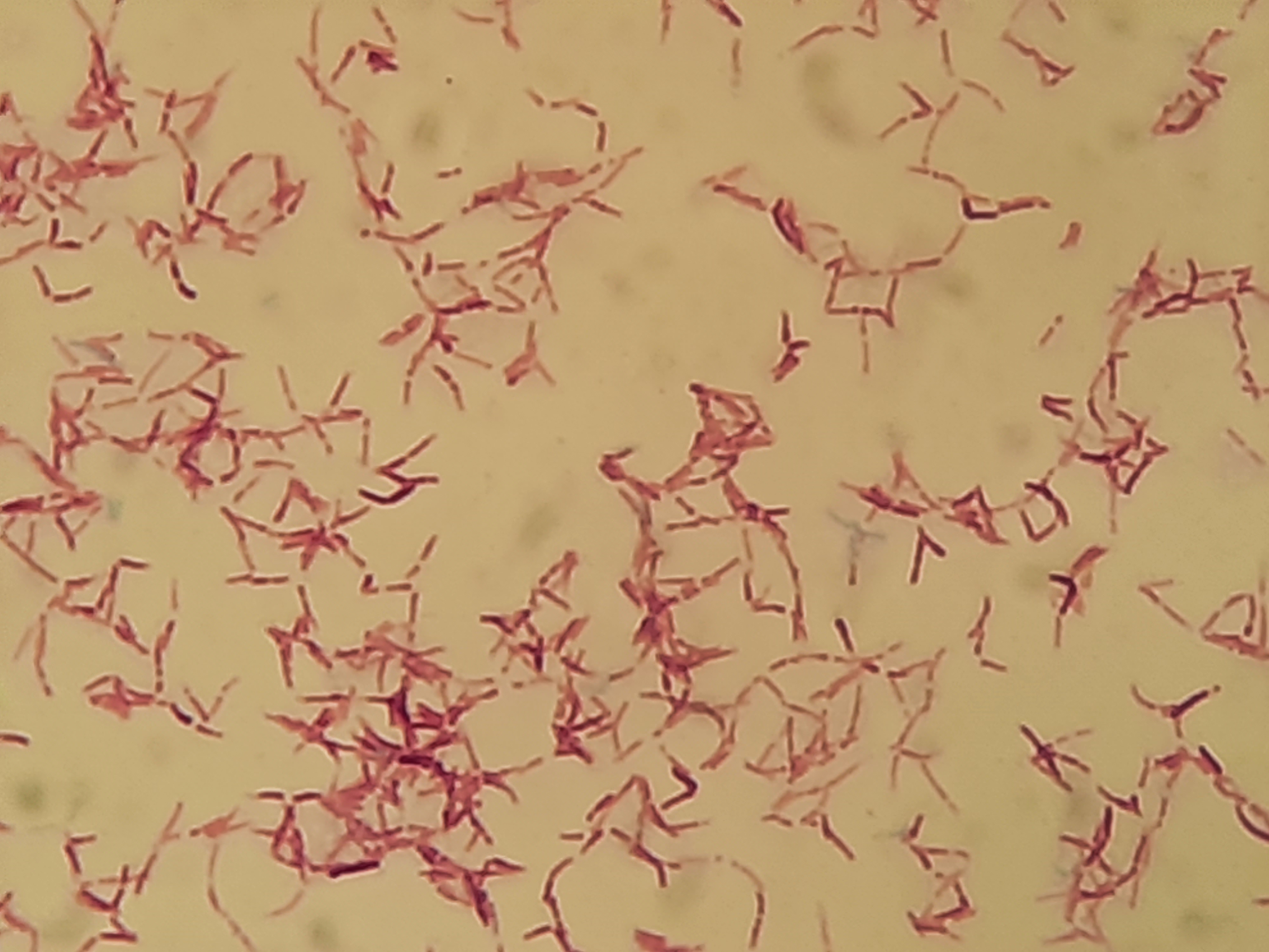 Nocardia spp. — Gram-positive filamentous, partially acid-fast