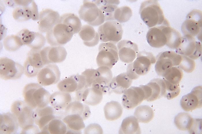 Plasmodium falciparum — Apicomplexan protozoan