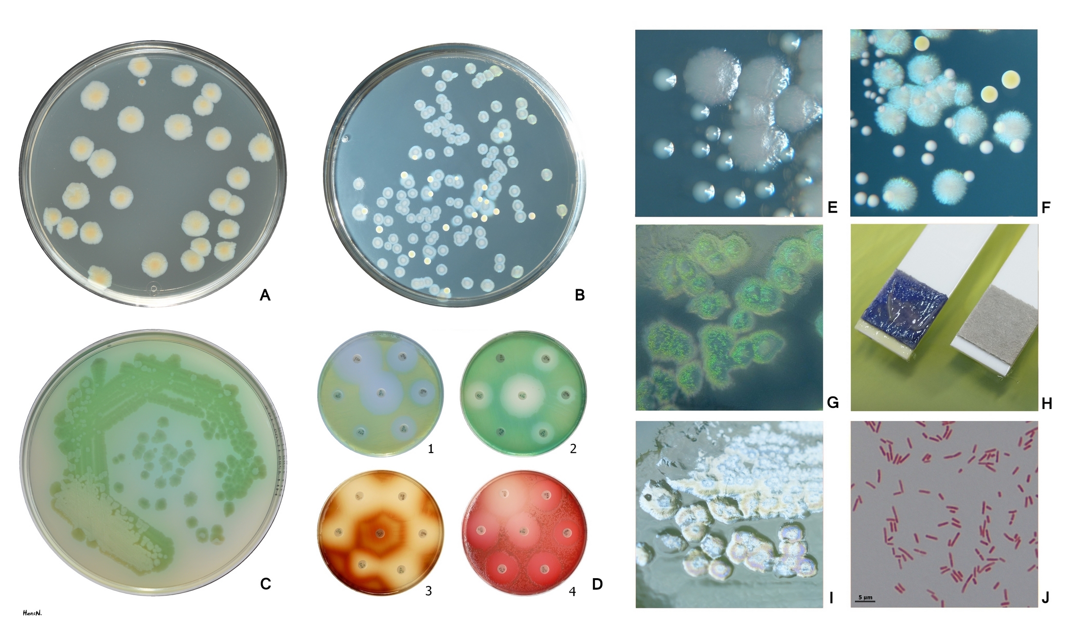 Pseudomonas aeruginosa — Gram-negative rod (non-fermenter)