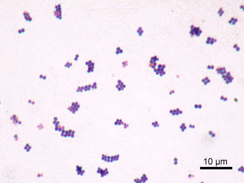 Staphylococcus aureus — Gram-positive cocci