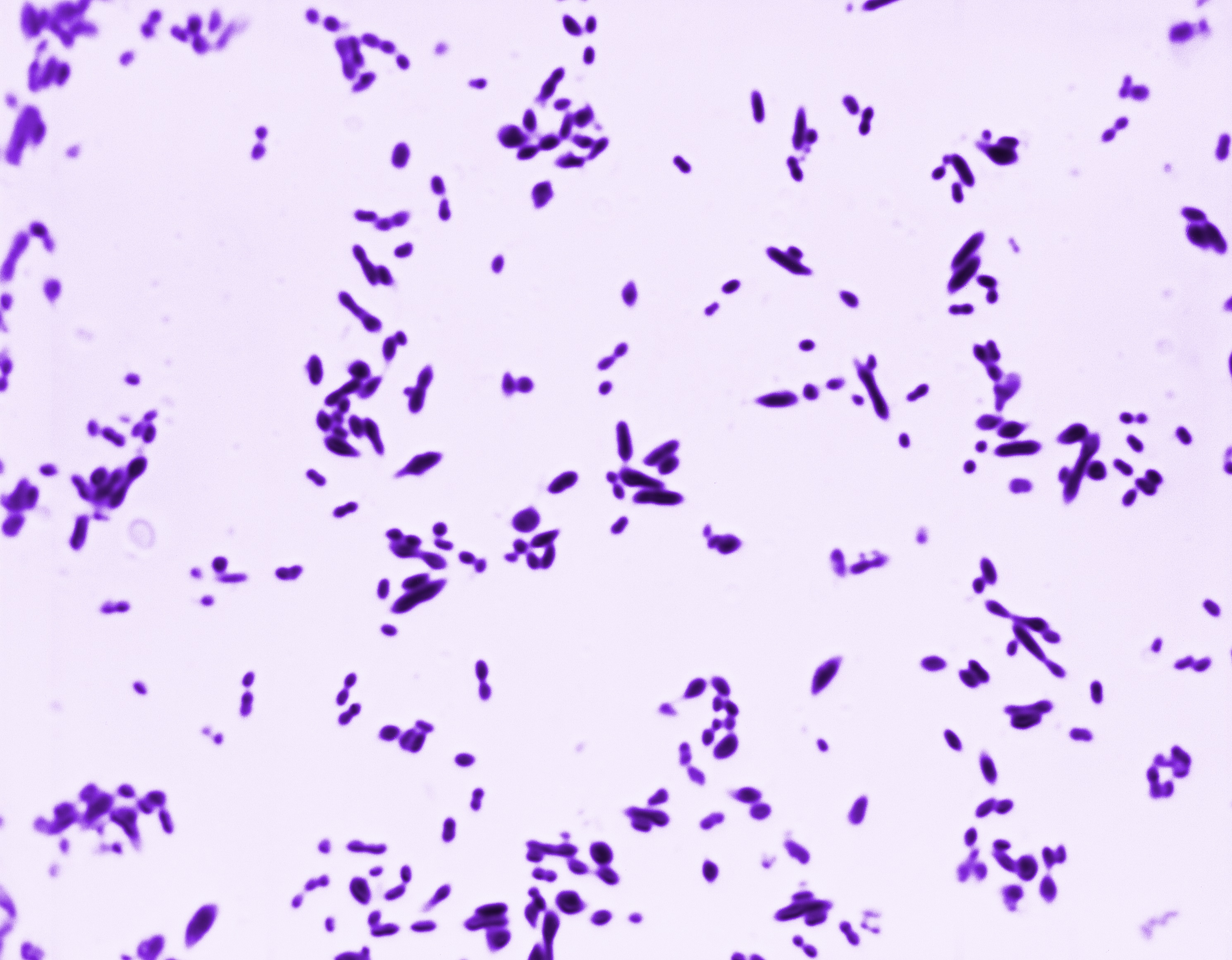 Streptococcus pneumoniae — Gram-positive cocci