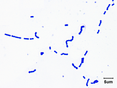 Streptococcus pyogenes (Group A Strep) — Gram-positive cocci