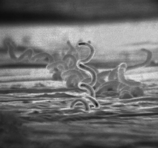 Treponema pallidum — Spirochete