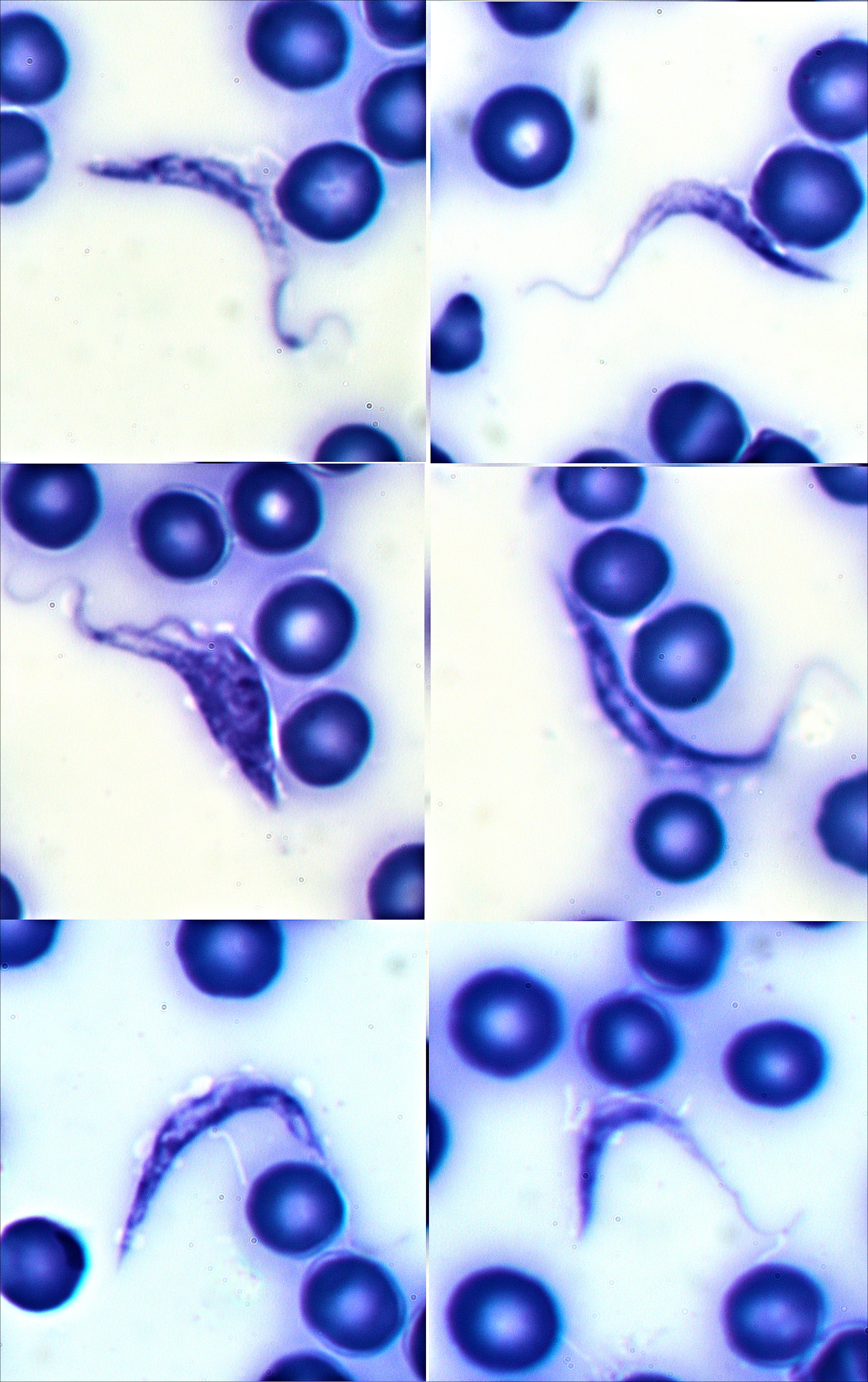 Trypanosoma cruzi — Hemoflagellate protozoan